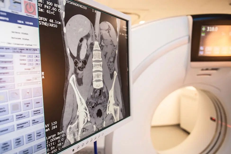 CT-scan-screen (1)