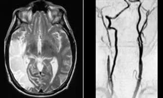 MR-Perfusion-Imaging-cover