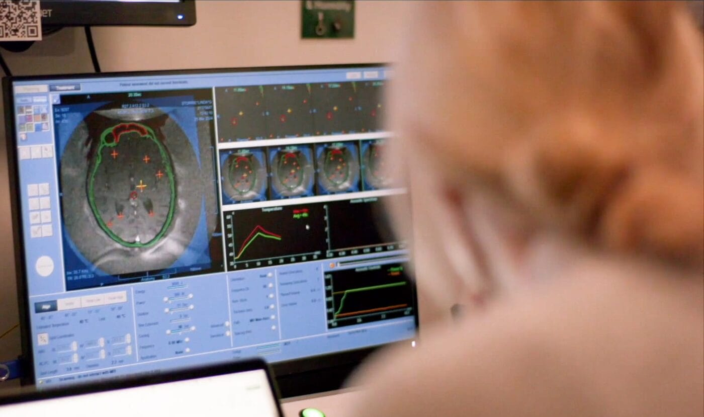 A surgeon undertaking MR guided focused ultrasound procedure for essential tremor.